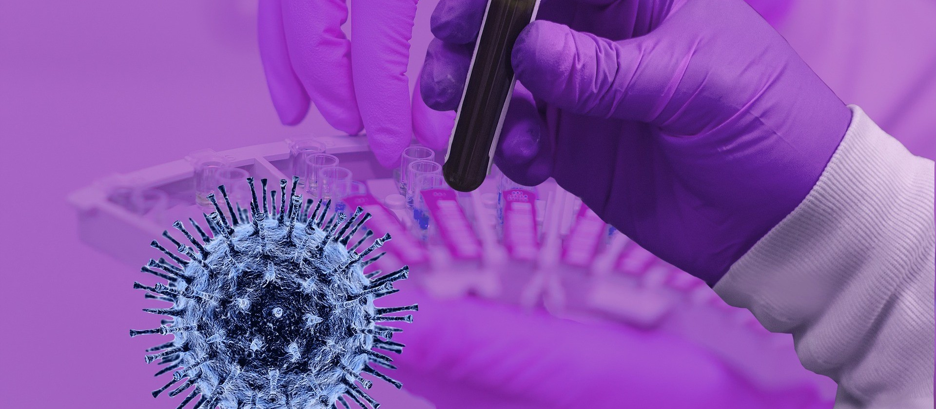 Sesa recomenda exame RT-PCR para quem viajou no feriado prolongado 