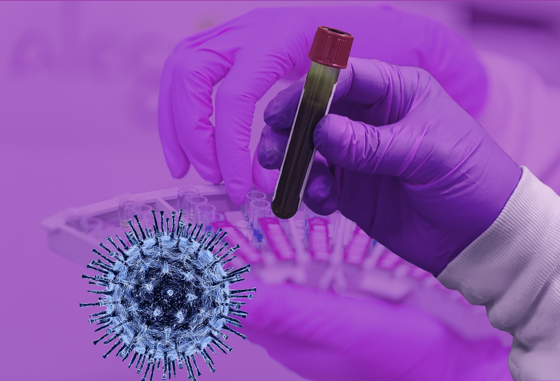 Sesa recomenda exame RT-PCR para quem viajou no feriado prolongado 
